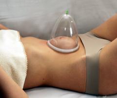 Cupping massage of the abdomen as a means of getting rid of defects in the waist area How to remove the stomach using vacuum cupping